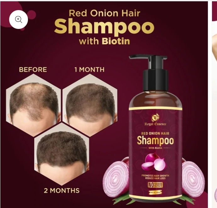 Regal Essence Red Onion Hair Shampoo for Unisex Hair Treatment- 300ml